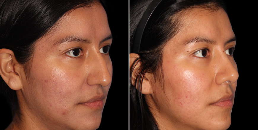 Plastic Surgery Results